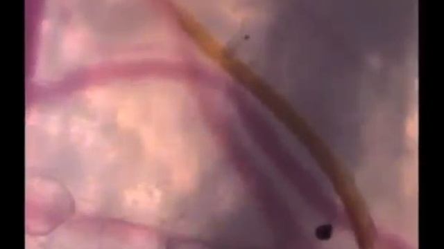 Укус комара смотреть онлайн