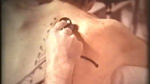 Плевральный выпот, академик Н.А.Мухин © Pleural effusion, аcademician N.A. Mukhin