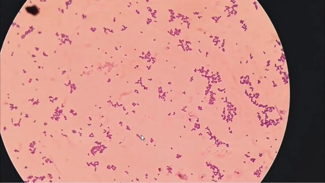 Streptococcus pyogenes identification смотреть онлайн