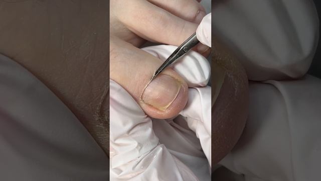 Если долго не делать педикюр #gelnails #pedicure #nails смотреть онлайн