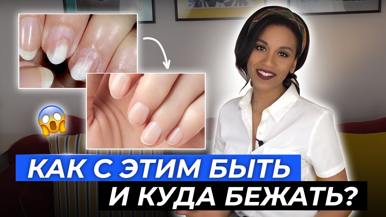 Ногти // Онихолизис: смотреть мастерам и их клиентам!// Вред гель-лака//Вылечить отслоение ногтей смотреть онлайн