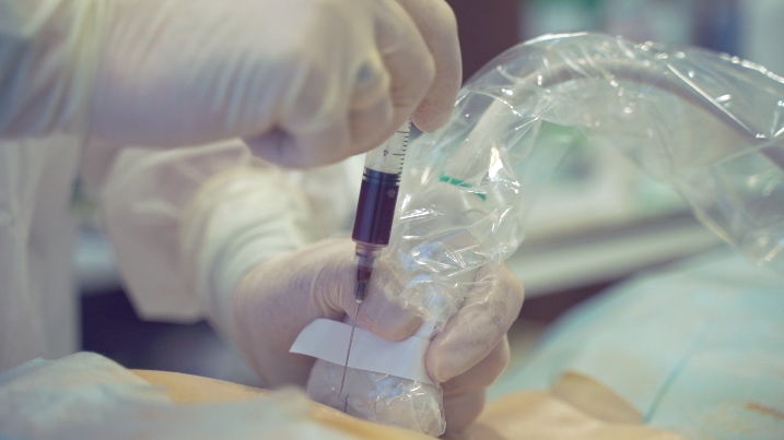 CORTEXIL PRP терапия сустава под УЗИ навигацией смотреть онлайн