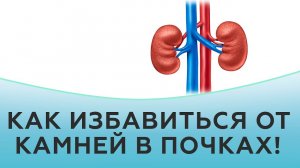 Как избавиться от камней в почках?