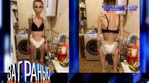 «За гранью»: «Кожа да кости» | Выпуск от 11 октября 2022 года