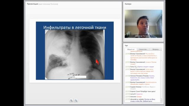 Рентгеносемиотика туберкулеза у больных ВИЧ-инфекцией смотреть онлайн