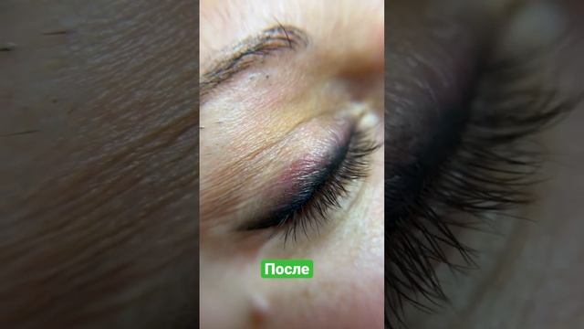 До и После татуажа век #перманентныймакияж #татуаж #татуажвек #стрелки #перманентныймакияжуроки смотреть онлайн