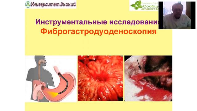 А Данилко Заболевания ЖКТ Язвенная болезнь желудка и 12 перст кишки 28 02 2016 смотреть онлайн