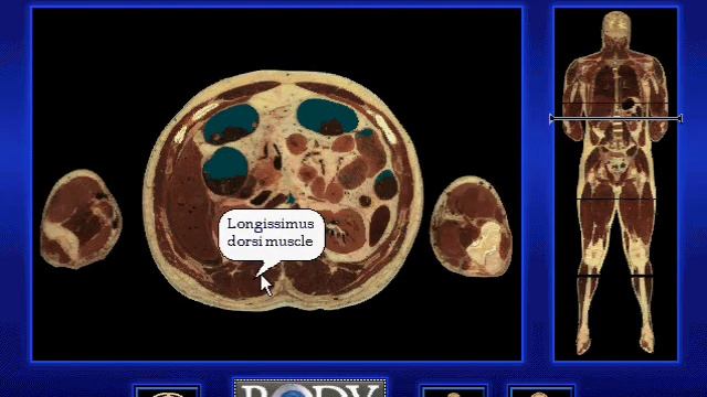 3-D Body Adventure (Windows Version) The Visible Body (plus intro) смотреть онлайн
