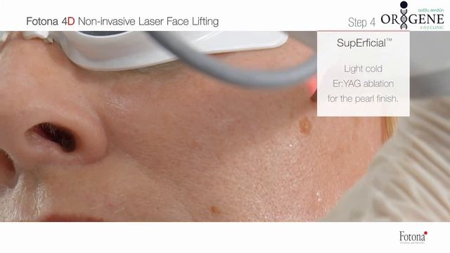Laser Face Lift by Fotona 4D смотреть онлайн