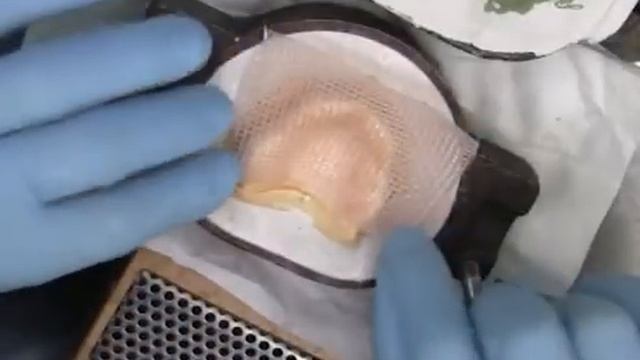 QUARTZ SPLINT MESH - полный съемный протез усиленный кварцевой шинирующей сеткой смотреть онлайн