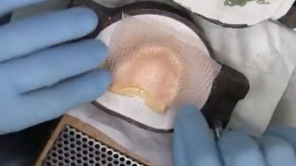 QUARTZ SPLINT MESH - полный съемный протез усиленный кварцевой шинирующей сеткой