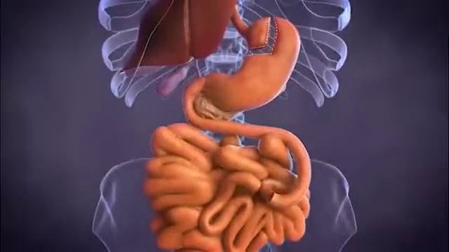 Gastric Bypass Surgery | Duke Health смотреть онлайн