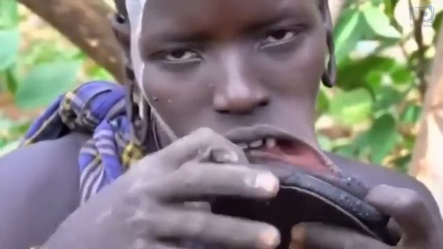 Wap Gen Gwo Difikilte Pou Kwè Sa Wap Gade La, Dezole Si Imaj Yo Deranje W