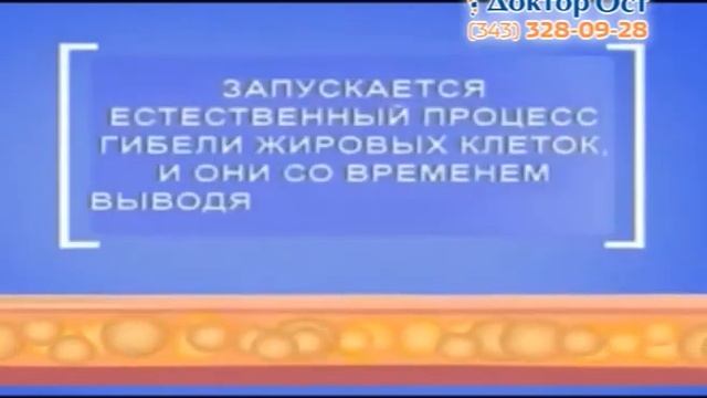 Худеем без проблем! Криолиполиз в МЦ Доктор Ост смотреть онлайн
