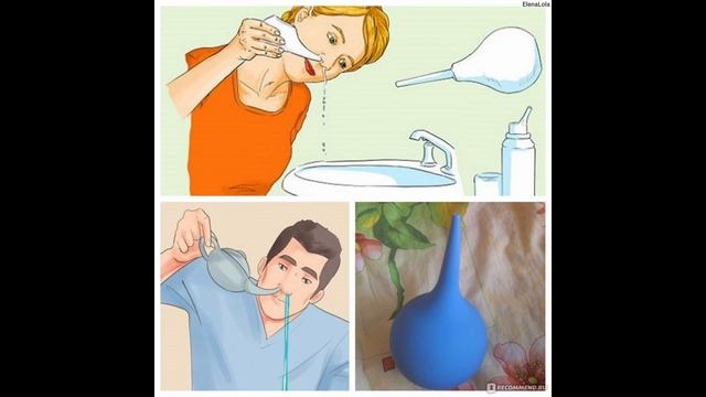 Профилактическое промывание носа(вода,соль,перекись,йод). Личный опыт. смотреть онлайн