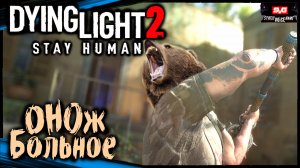 (Лагерь Бандосов - Бл...й Гризли) - Dying Light 2 Stay Human Прохождение (#9)