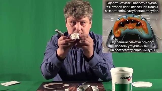 Как нужно отснять слепки с зубов смотреть онлайн