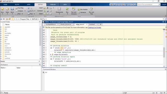 Working with MATLAB on DICOM images: An easy tutorial for beginners смотреть онлайн