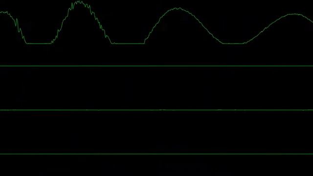 Jazz Jackrabbit - Medivo (song17) - Skylar's Oscilloscope Stuff смотреть онлайн