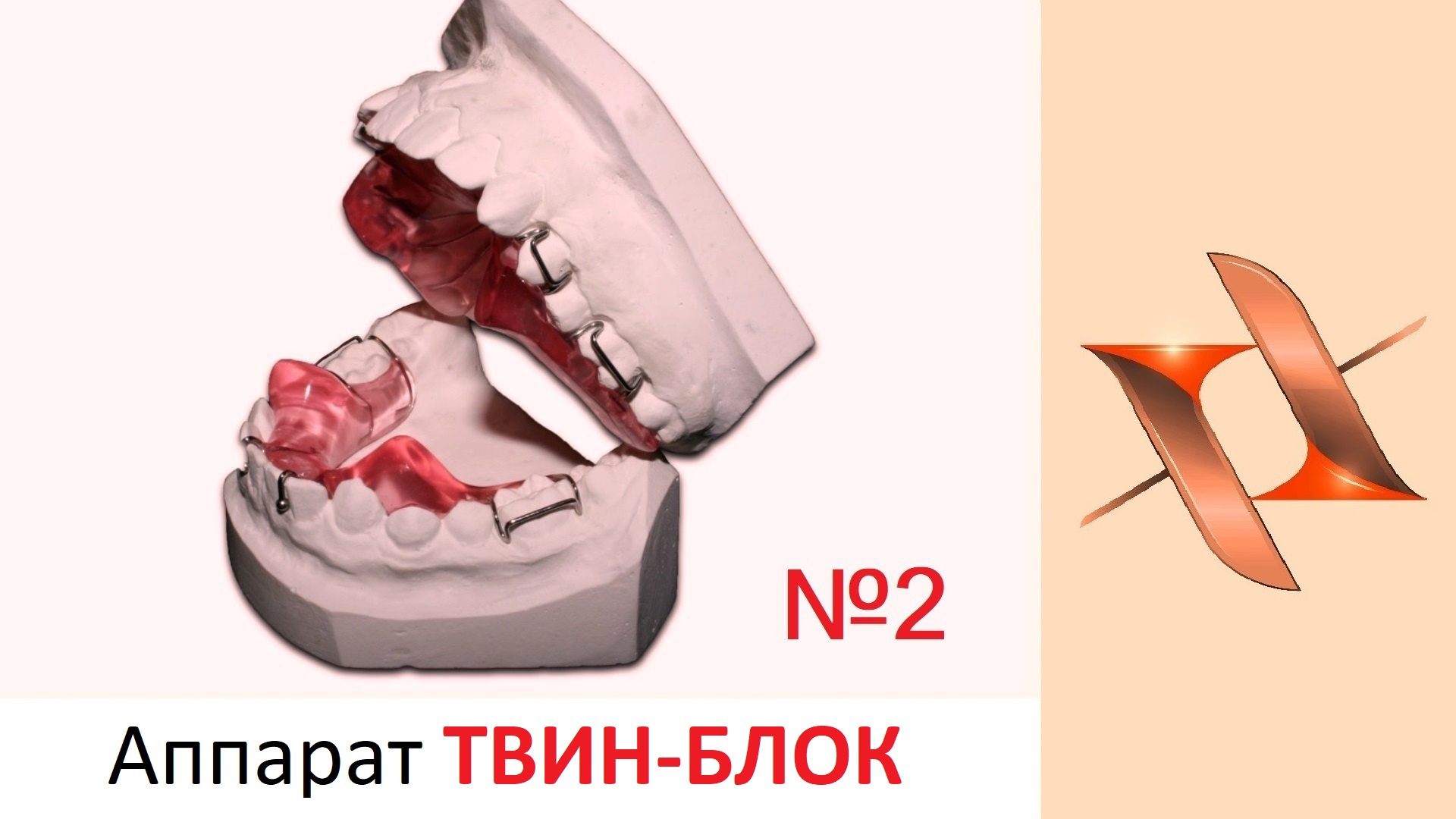 Функциональный аппарат Твин Блок - Twin Block. Часть 2. Ортодонтия. смотреть онлайн