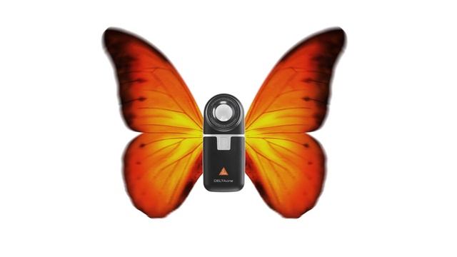 HEINE DELTAone Dermatoscope — Teaser смотреть онлайн