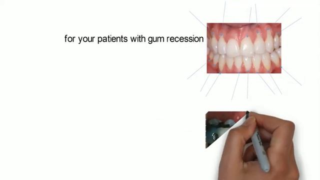 Curaprox 5460 Ultra-soft Toothbrush смотреть онлайн