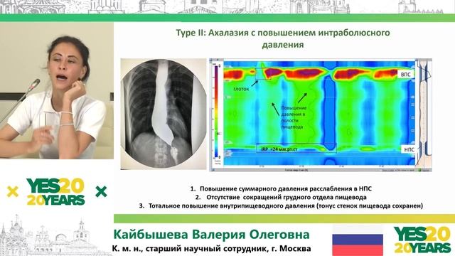 66. Роль манометрии пищевода в выборе тактики лечения пациентов с ГЭРБ. В. О. Кайбышева смотреть онлайн
