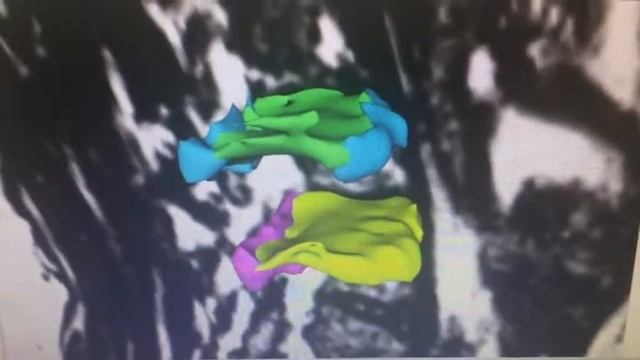 MG-960 смотреть онлайн