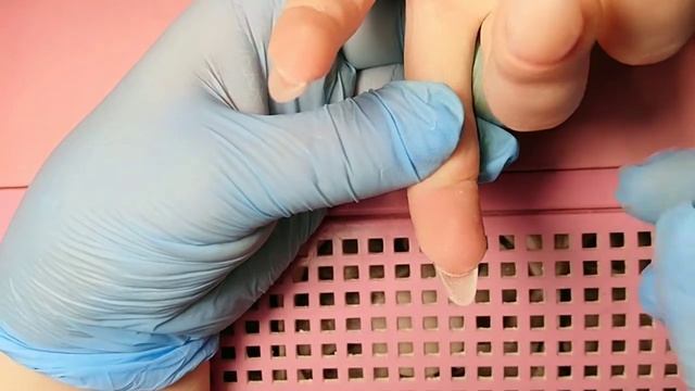 Ноготок после панариция. смотреть онлайн