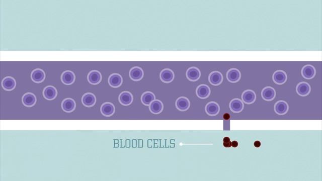 What are stem cells? - Craig A. Kohn смотреть онлайн