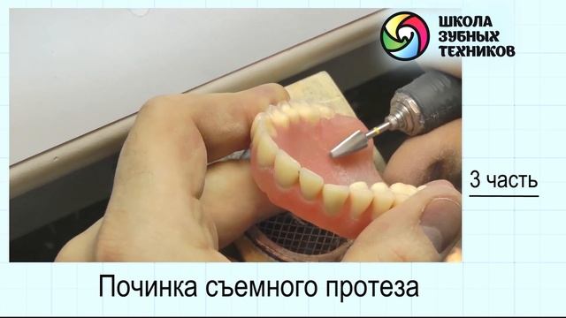 "Починка съемного протеза" часть №3 смотреть онлайн