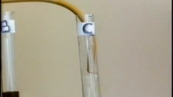 Дуоденальное зондирование © Duodenal intubation