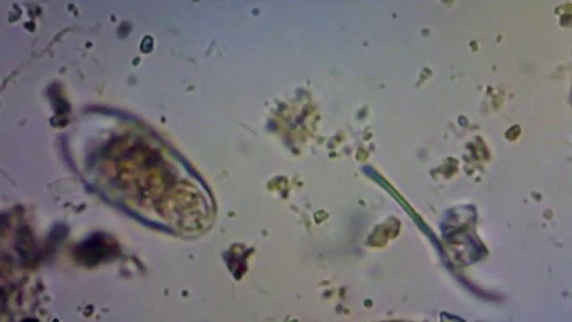 Compost Microbes смотреть онлайн