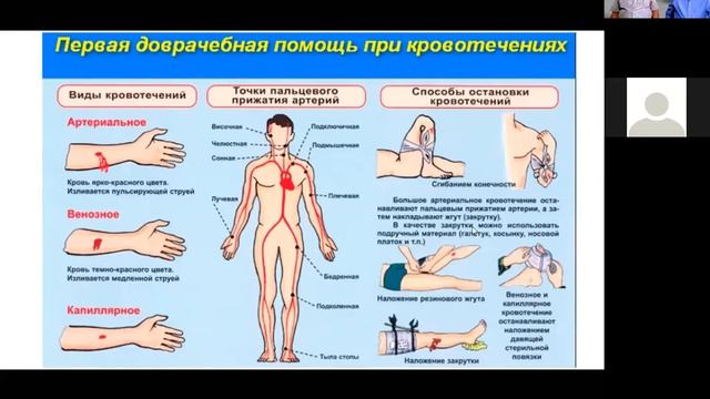 Занятие 17 _ 10.07.2020 _ ОКАЗАНИЕ ПЕРВОЙ МЕДИЦИНСКОЙ ПОМОЩИ ДТП смотреть онлайн