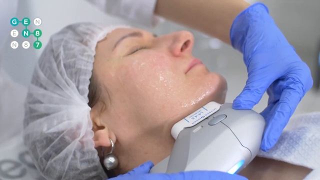 SMAS лифтинг лица на аппарате ULTRAFORMER | Ультраформер смотреть онлайн