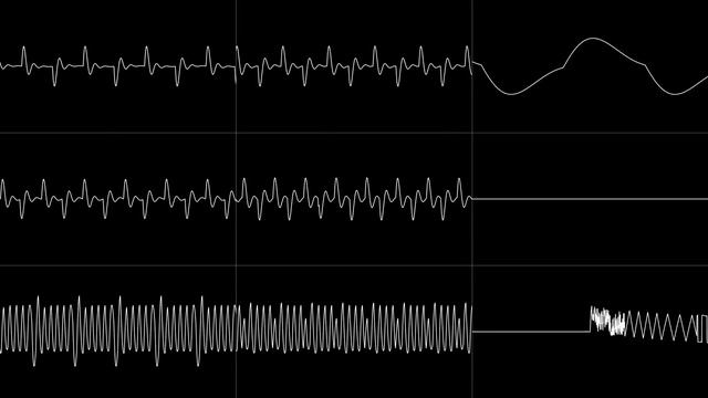 Jammer - “Melbourne Shuffle” (C64) [Oscilloscope View] смотреть онлайн