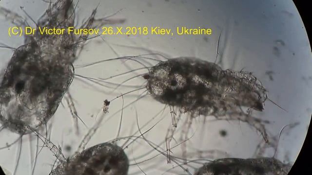 Миллион Мучных Клещей Acarus siro! Клещи Под Микроскопом. смотреть онлайн