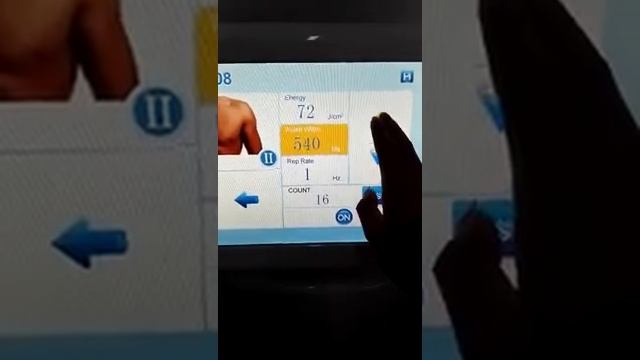Диодный лазер для эпиляции Р-808нм экран смотреть онлайн