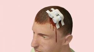 Первая помощь при травме головы, груди и живота.