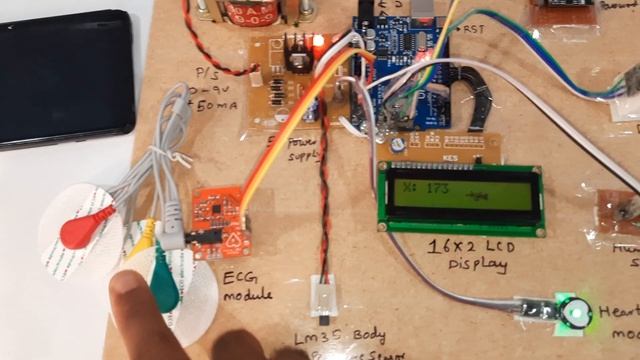 IoT Based LM35 | Heart Rate | Humidity | ECG | FALL Monitoring on Thingspeak using ESP8266 & Arduin смотреть онлайн