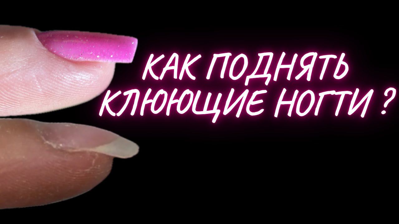 КАК ПОДНЯТЬ КЛЮЮЩИЕ НОГТИ? Коррекция гелем тонко! смотреть онлайн