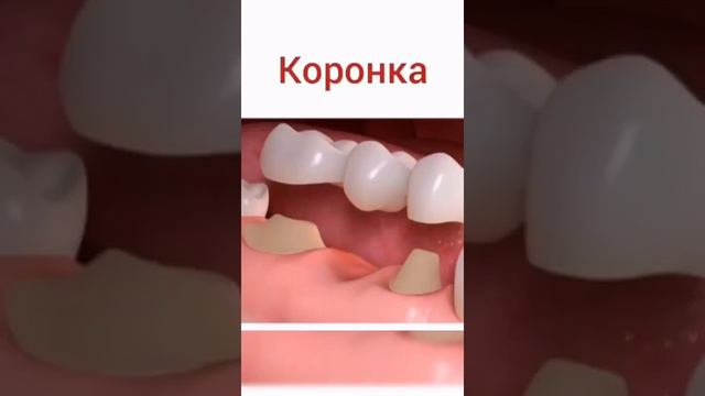 Зубной техник смотреть онлайн