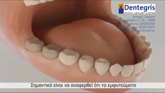 Dental Implant Dentegris смотреть онлайн