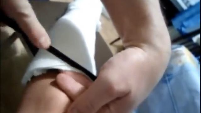 Гипс при переломе лодыжки в домашних условиях обрезаем. Девушка в гипсе. Girl in a cast смотреть онлайн