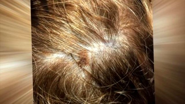Парикмахер увидела пятно на голове и застыла. Затем она спасла ей жизнь смотреть онлайн
