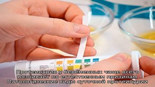Суточная протеинурия смотреть онлайн