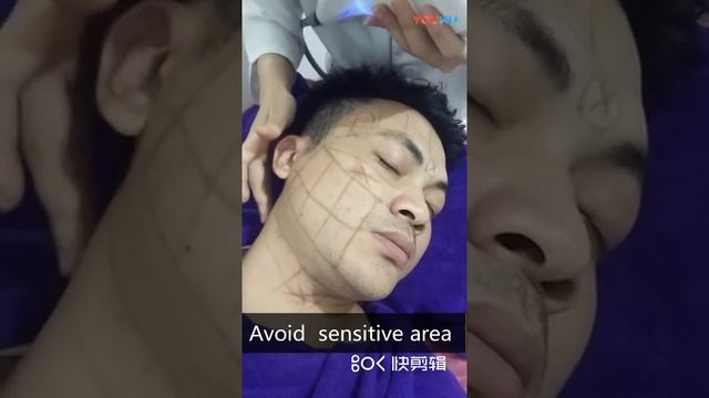 Instruction for 4d hifu face lift machine смотреть онлайн