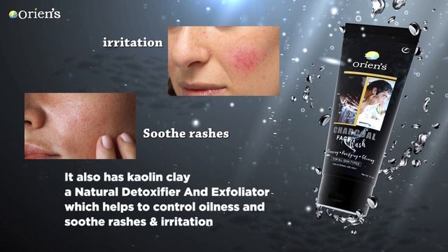 Charcoal Face wash | Oriens | Removes dead skin cells | Improves skin texture | Wrinkle-free skin смотреть онлайн