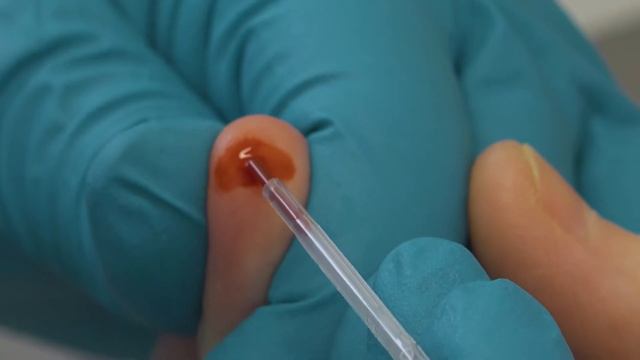 В регионах СвЖД начал работать мобильный комплекс РЖД Медицины смотреть онлайн