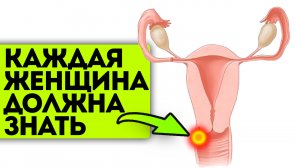 Смотрите, как я справилась с молочницей дома! Молочница боится алоэ и обычную...